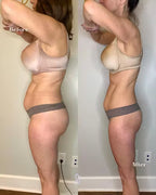 GLP-1 Weight Management Support Patches – 30 Count