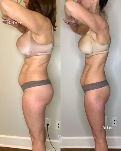 GLP-1 Weight Management Support Patches – 30 Count